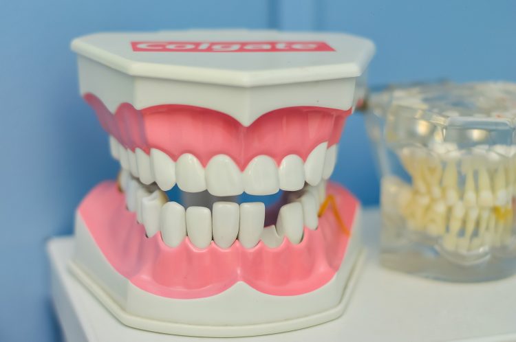 口の中 歯 マクロモデル 歯医者